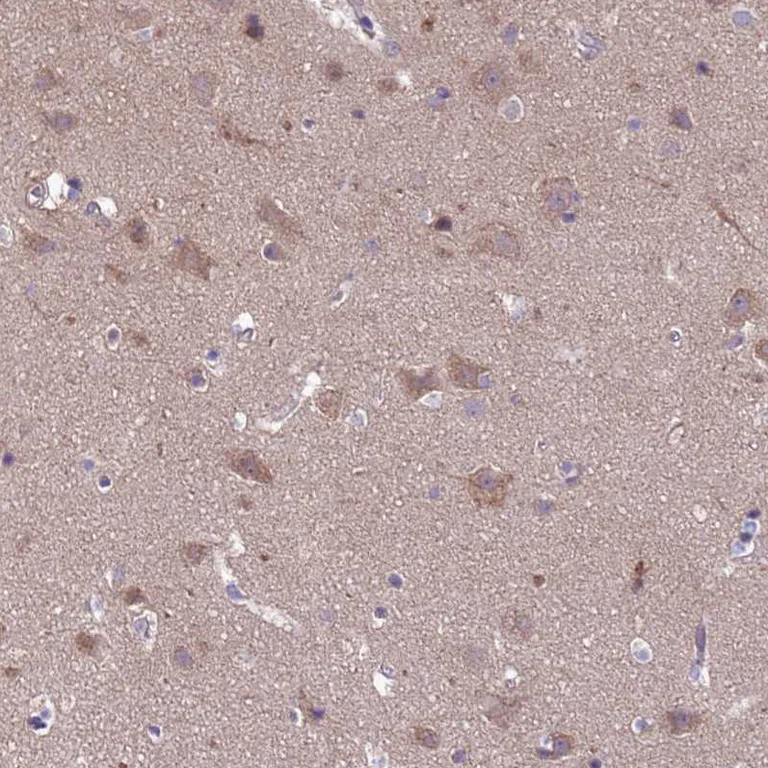 Immunohistochemistry (Formalin/PFA-fixed paraffin-embedded sections) - Anti-Dexras1 antibody (AB251924)