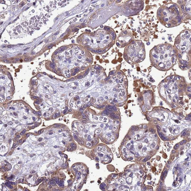 Immunohistochemistry (Formalin/PFA-fixed paraffin-embedded sections) - Anti-Dexras1 antibody (AB251924), expandable thumbnail