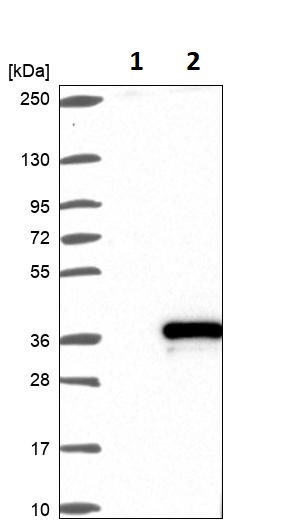 Western blot - Anti-Dexras1 antibody (AB251924), expandable thumbnail