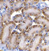Immunohistochemistry (Formalin/PFA-fixed paraffin-embedded sections) - Anti-DFFB/CAD antibody (AB8401)