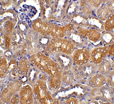 Immunohistochemistry (Formalin/PFA-fixed paraffin-embedded sections) - Anti-DFFB/CAD antibody (AB8401)