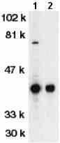 Western blot - Anti-DFFB/CAD antibody (AB8408), expandable thumbnail