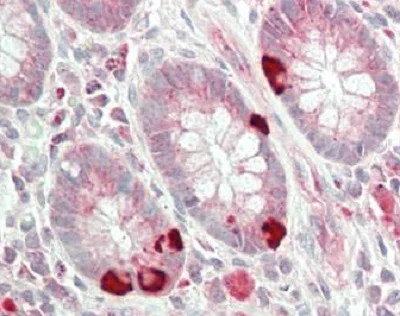 Immunohistochemistry (Formalin/PFA-fixed paraffin-embedded sections) - Anti-DFNA5/GSDME antibody (AB230482)