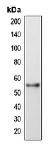 Western blot - Anti-DFNA5/GSDME antibody (AB230482)