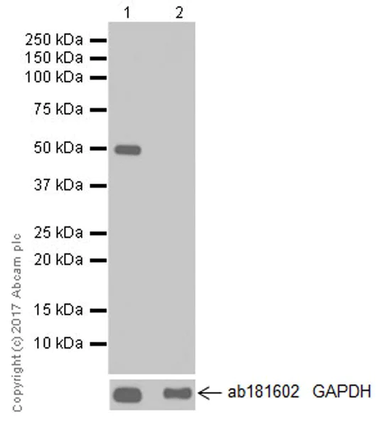 Western blot - Anti-DFNA5/GSDME antibody [EPR19859-60] - BSA and Azide free (AB225893)