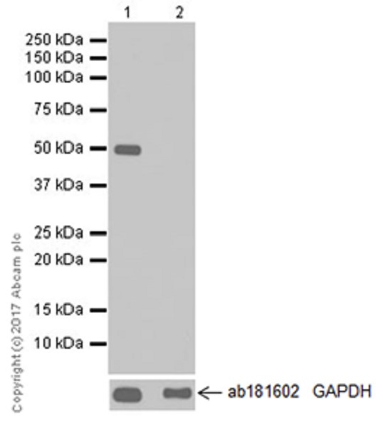 Western blot - Anti-DFNA5/GSDME antibody [EPR19859-60] - C-terminal (AB221843), expandable thumbnail