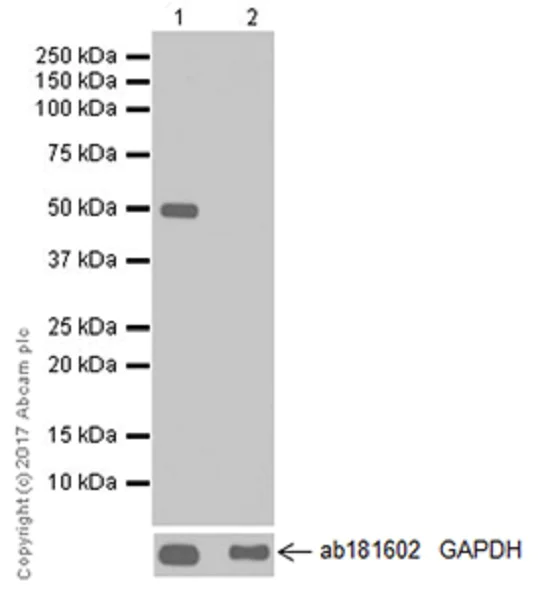 Western blot - Anti-DFNA5/GSDME antibody [EPR19859-60] - C-terminal (AB221843)