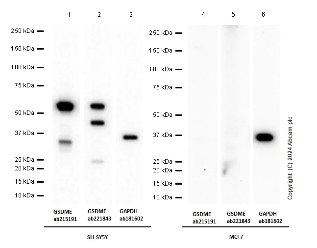 Western blot - Anti-DFNA5/GSDME antibody [EPR19859-60] - C-terminal (AB221843)