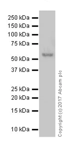 Western blot - Anti-DFNA5/GSDME antibody [EPR19859] - N-terminal (AB215191)