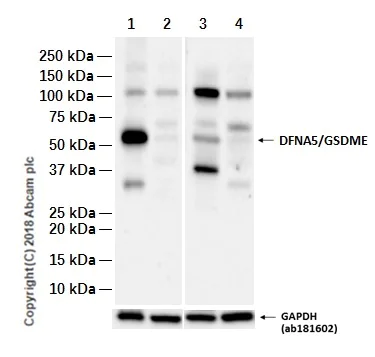 Western blot - Anti-DFNA5/GSDME antibody [EPR19859] - N-terminal (AB215191)