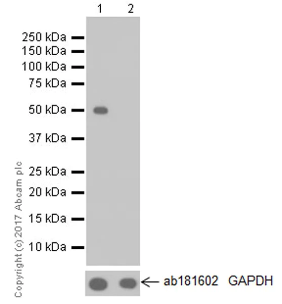 Western blot - Anti-DFNA5/GSDME antibody [EPR19859] - N-terminal (AB215191)