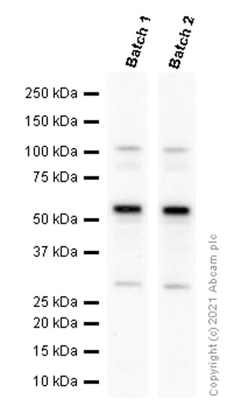 Western blot - Anti-DFNA5/GSDME antibody [EPR19859] - N-terminal (AB215191)