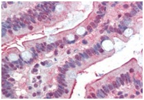 Immunohistochemistry (Formalin/PFA-fixed paraffin-embedded sections) - Anti-DGAT1 antibody (AB189994)