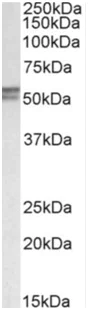 Western blot - Anti-DGAT1 antibody (AB189994)