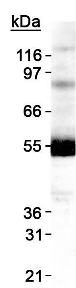 Western blot - Anti-DGAT1 antibody (AB54037)