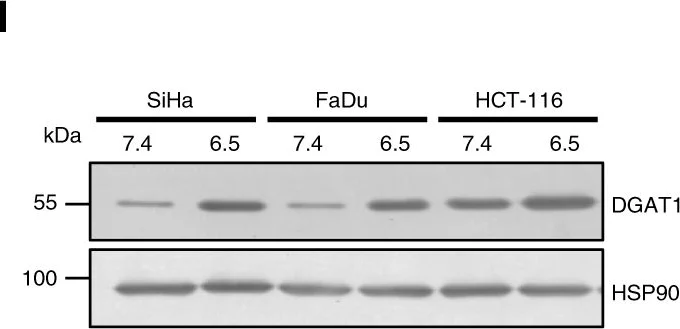Western blot - Anti-DGAT1 antibody (AB54037)