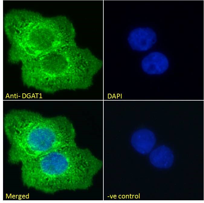 Immunocytochemistry/ Immunofluorescence - Anti-DGAT1 antibody (AB59034)