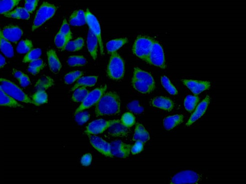 Immunocytochemistry/ Immunofluorescence - Anti-DGAT1 antibody [EPR13430-4] - BSA and Azide free (AB240250)
