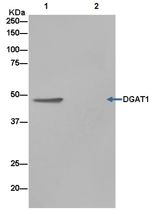 Immunoprecipitation - Anti-DGAT1 antibody [EPR13430-4] - BSA and Azide free (AB240250)