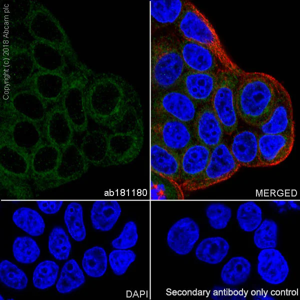 Immunocytochemistry/ Immunofluorescence - Anti-DGAT1 antibody [EPR13430-4] - N-terminal (AB181180)