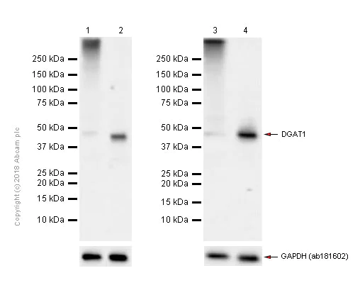 Western blot - Anti-DGAT1 antibody [EPR13430-4] - N-terminal (AB181180)
