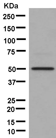 Western blot - Anti-DGAT1 antibody [EPR13430-4] - N-terminal (AB181180)