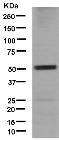 Western blot - Anti-DGAT1 antibody [EPR13430-4] - N-terminal (AB181180)
