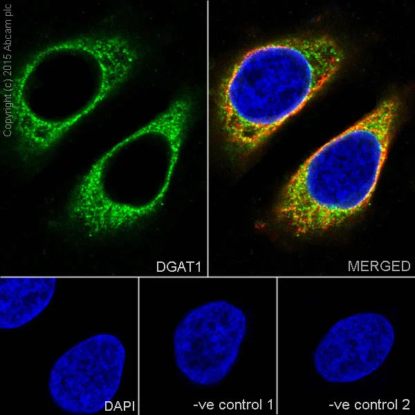 Immunocytochemistry/ Immunofluorescence - Anti-DGAT1 antibody [EPR13430] - BSA and Azide free (AB250080)
