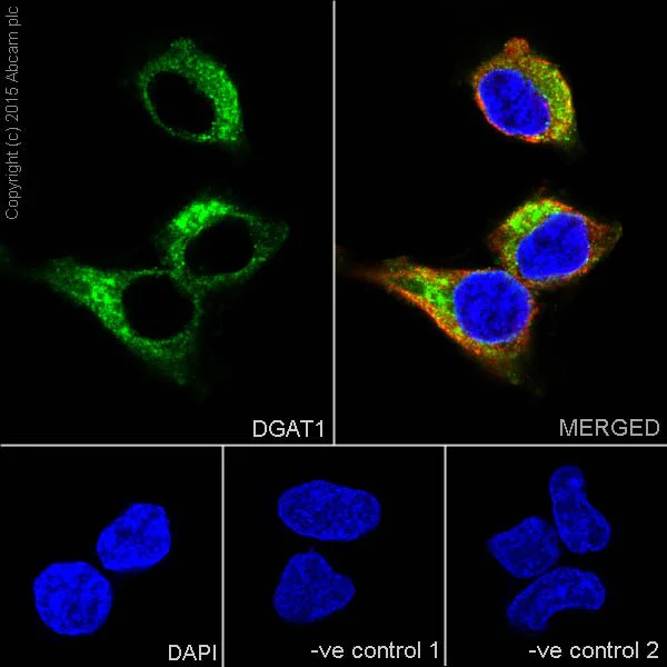 Immunocytochemistry/ Immunofluorescence - Anti-DGAT1 antibody [EPR13430] - BSA and Azide free (AB250080)