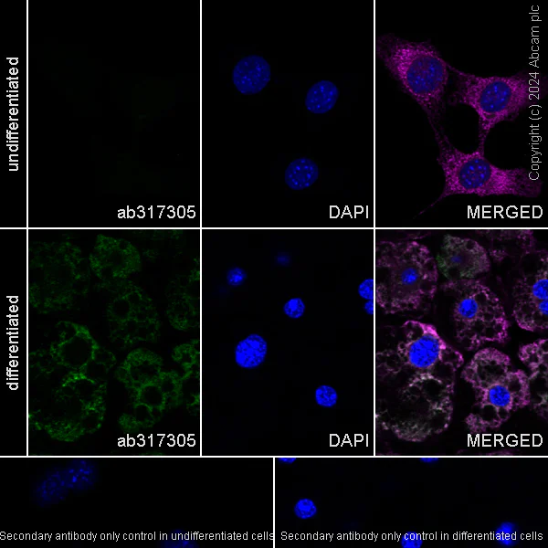 Immunocytochemistry/ Immunofluorescence - Anti-DGAT1 antibody [EPR28418-75] - BSA and Azide free (AB317306)