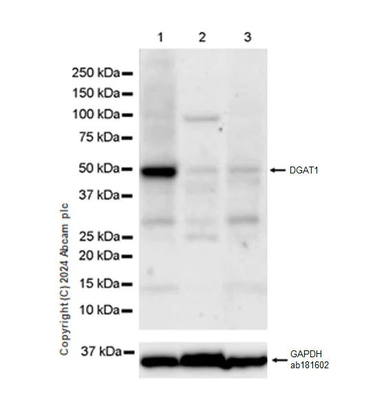 Western blot - Anti-DGAT1 antibody [EPR28418-75] - BSA and Azide free (AB317306)