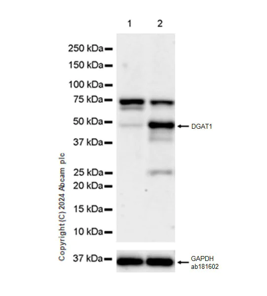 Western blot - Anti-DGAT1 antibody [EPR28418-75] - BSA and Azide free (AB317306)