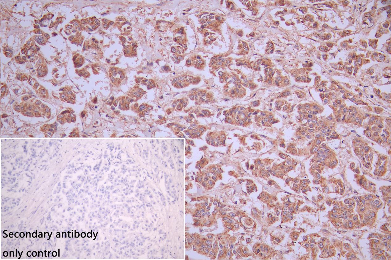 Immunohistochemistry (Formalin/PFA-fixed paraffin-embedded sections) - Anti-DGAT2 antibody (AB237613)