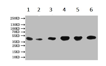 Western blot - Anti-DGAT2 antibody (AB237613)