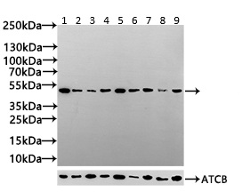 Western blot - Anti-DGAT2 antibody (AB237613)