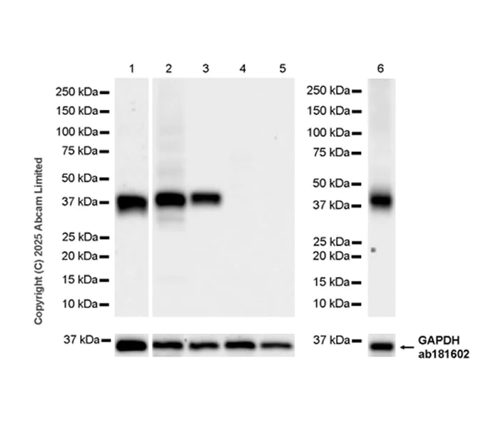 Western blot - Anti-DGAT2 antibody [EPR27385-45] (AB325121)
