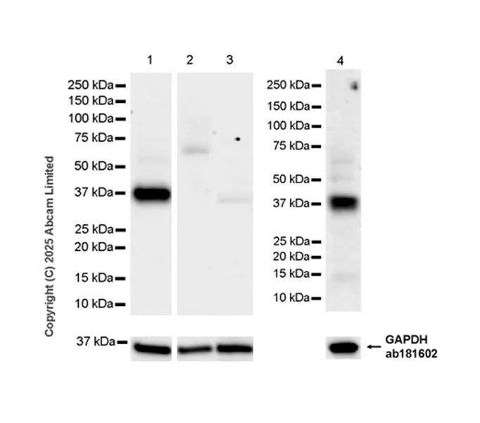 Western blot - Anti-DGAT2 antibody [EPR27385-45] (AB325121)
