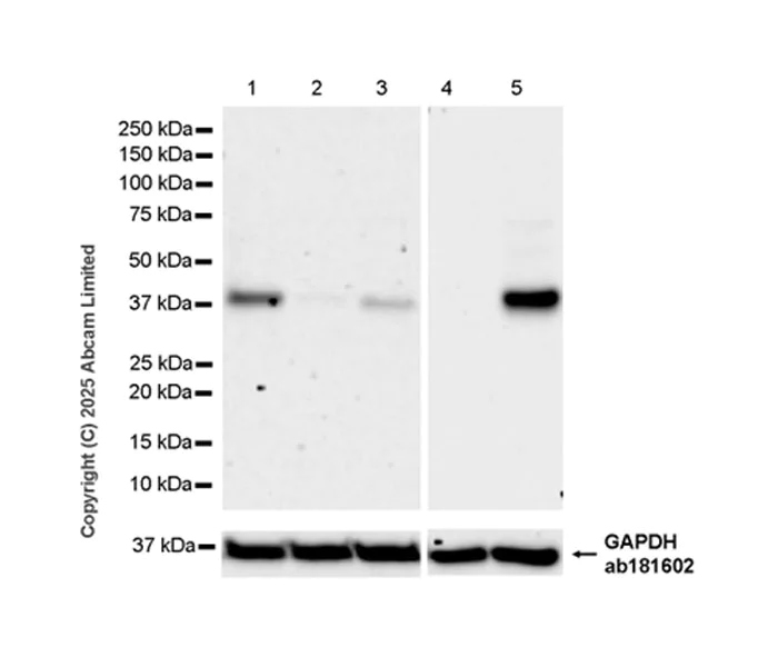 Western blot - Anti-DGAT2 antibody [EPR27385-45] (AB325121)