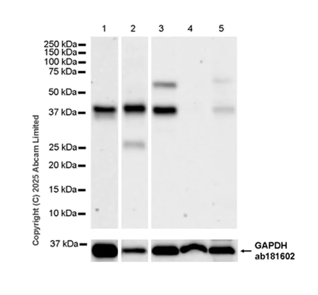 Western blot - Anti-DGAT2 antibody [EPR27385-45] (AB325121)