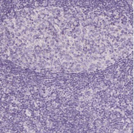 Immunohistochemistry (Formalin/PFA-fixed paraffin-embedded sections) - Anti-DGAT2L4 antibody (AB204904)