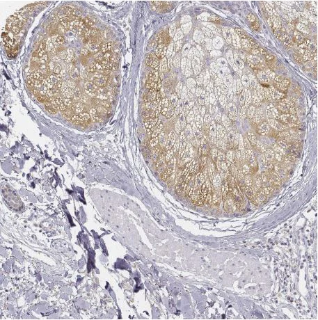 Immunohistochemistry (Formalin/PFA-fixed paraffin-embedded sections) - Anti-DGAT2L4 antibody (AB204904)