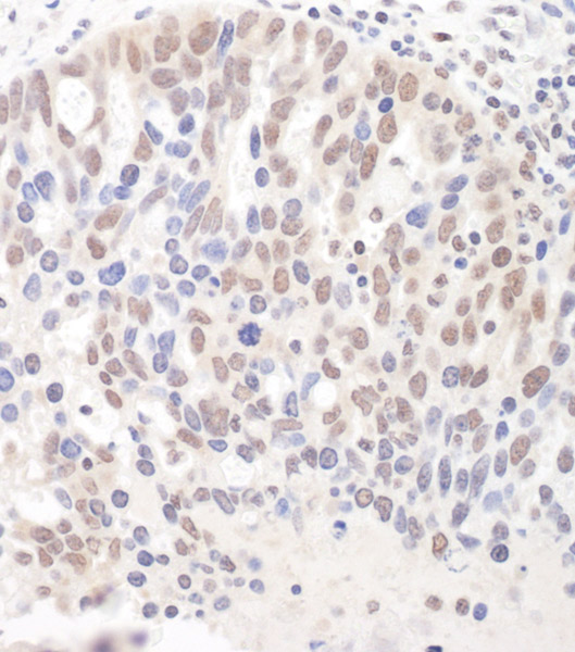 Immunohistochemistry (Formalin/PFA-fixed paraffin-embedded sections) - Anti-DGCR8 antibody (AB90649)