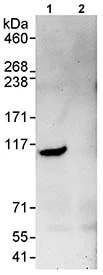Immunoprecipitation - Anti-DGCR8 antibody (AB90649)