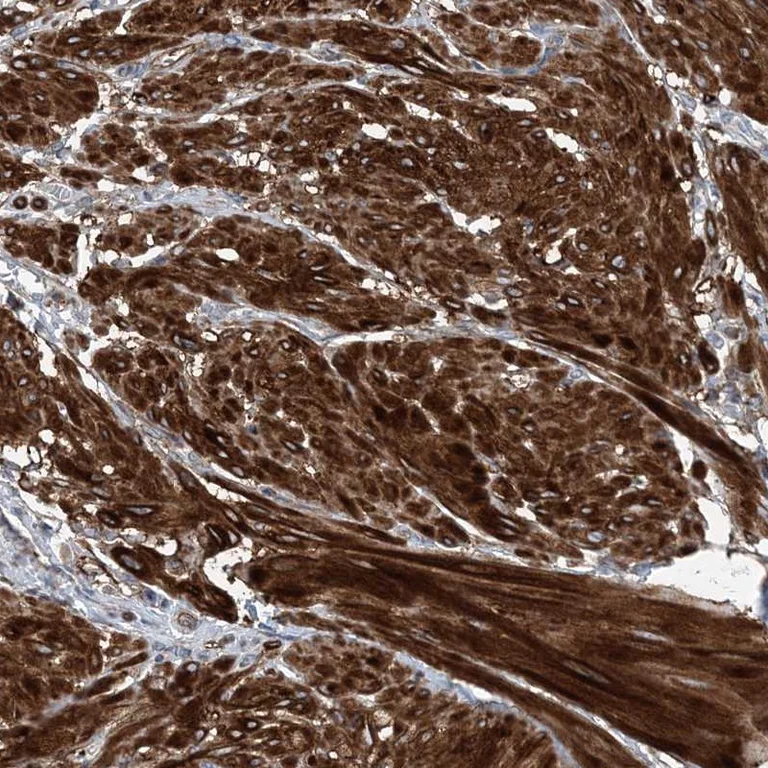 Immunohistochemistry (Formalin/PFA-fixed paraffin-embedded sections) - Anti-dGK antibody (AB262847)