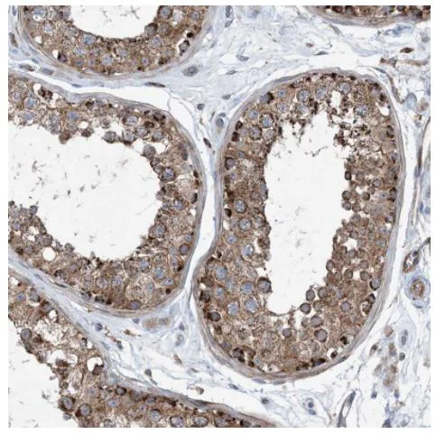 Immunohistochemistry (Formalin/PFA-fixed paraffin-embedded sections) - Anti-dGK antibody (AB262847)