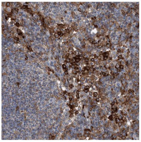 Immunohistochemistry (Formalin/PFA-fixed paraffin-embedded sections) - Anti-dGK antibody (AB262847)