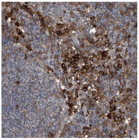 Immunohistochemistry (Formalin/PFA-fixed paraffin-embedded sections) - Anti-dGK antibody (AB262847)
