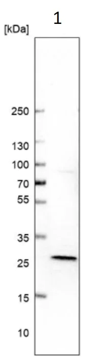 Western blot - Anti-dGK antibody (AB262847)
