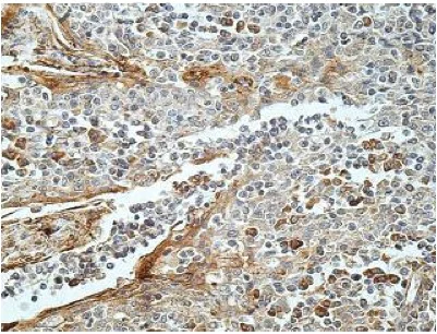Immunohistochemistry (Formalin/PFA-fixed paraffin-embedded sections) - Anti-DGKA antibody (AB197249)