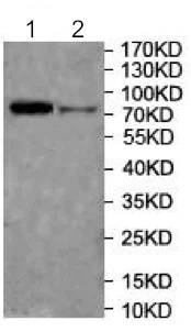 Western blot - Anti-DGKA antibody (AB197249)